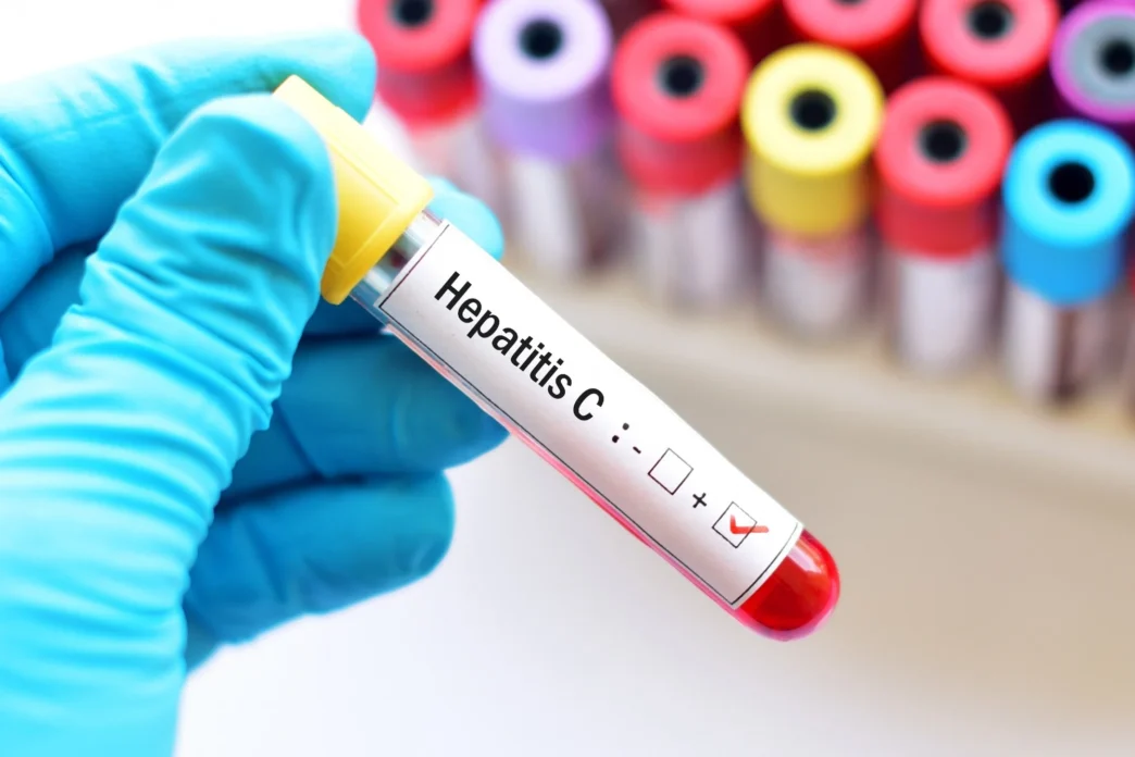 hepatitis c